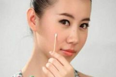 用粉刺針挑完痘痘后應(yīng)該做什么？挑完痘痘要怎么護理？[圖]