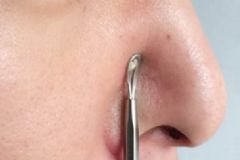 用粉刺針挑痘痘會不會留疤？用粉刺針劃痘痘變黑怎么辦？[圖]