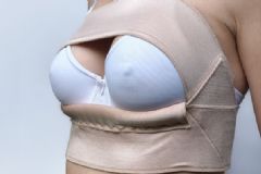 自體脂肪隆胸需要多久能恢復(fù)？自體脂肪隆胸術(shù)后需要注意什么？[圖]