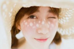 激光點(diǎn)痣會(huì)留疤嗎？激光點(diǎn)痣要點(diǎn)幾次？[圖]