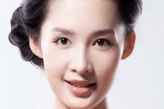 如何去除眼袋？去除眼袋用什么方法？[圖]