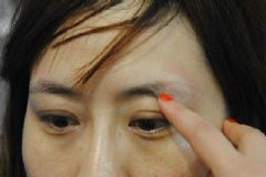 激光洗眉后紅印怎么樣淡化？激光洗眉后紅印怎么辦？[圖]