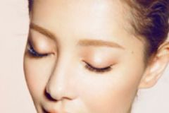 眼窩凹陷催人老 眼窩凹陷怎么恢復(fù)？[圖]