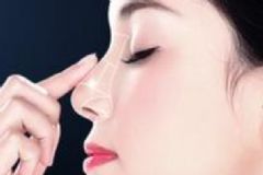 玻尿酸隆鼻能保持多久？玻尿酸隆鼻多久消腫？[多圖]