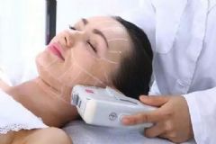 超聲刀美容有副作用嗎？超聲刀美容適合多大年齡做？[多圖]