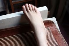 腳趾甲變厚怎么辦？腳趾甲變厚怎么治療？[圖]
