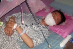 腦膜炎和腦炎有什么區(qū)別？腦膜炎和腦炎的區(qū)別？[圖]