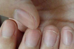 怎樣通過指甲看身體健康狀況？怎樣從指甲看出男人腎虛？[圖]