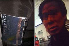 為跟女友分手裝精神病，精神病是什么樣子的？[多圖]