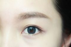 貼雙眼皮貼會變雙嗎？貼雙眼皮貼會變成會變成雙眼皮嗎？[多圖]