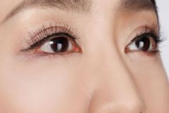 雙眼皮手術(shù)有幾種？雙眼皮手術(shù)有風險嗎？[多圖]