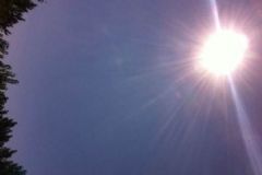 夏天曬傷了怎么辦？夏天曬傷怎么辦？[多圖]