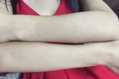 女生手臂汗毛多是怎么回事？女生手臂汗毛長(zhǎng)怎么辦？[多圖]