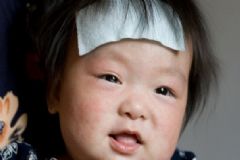 幼兒急疹出疹后如何護理？幼兒急疹如何預(yù)防？[圖]