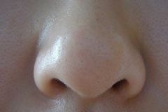 黑頭是螨蟲嗎？黑頭和螨蟲的區(qū)別是什么？[多圖]