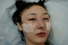 整容上癮怎么辦？整容上癮要怎么調(diào)整心態(tài)？[多圖]