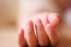 寶寶手指上為什么會(huì)脫皮？寶寶手指脫皮怎么治？[圖]