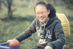 15歲塌鼻子可以捏高嗎？15歲塌鼻子怎么辦？[多圖]