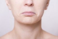 女人臉腫是是什么原因？女人臉浮腫怎么消腫？[圖]