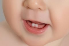 寶寶長(zhǎng)牙很難受怎么辦？寶寶長(zhǎng)牙難受如何緩解？[圖]