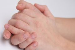 如何治療凍瘡最有效？?jī)霪彽闹委煼椒ㄓ心男?？[圖]