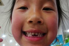 小孩換牙乳牙不掉怎么辦？小孩換牙老不掉怎么辦？[圖]