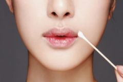 坐月子嘴唇起皮怎么緩解？坐月子嘴唇起皮如何緩解？[圖]