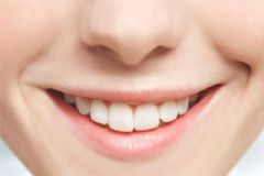 得了牙周病該怎么辦？發(fā)生牙周病的原因都有哪些？[圖]