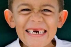 孩子換牙期要注意什么？孩子換牙的時(shí)候有什么要注意的地方？[圖]