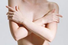 女性胸部下垂怎么鍛煉？女性胸部下垂的原因[圖]