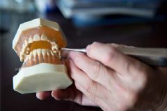 哪些人不適合帶活動假牙？老年人帶的假牙需多久換一次？[圖]