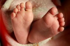 引起扁平足的原因有哪些？扁平足患者走路為什么容易累？[圖]