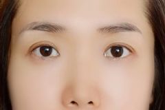掉眉毛是什么征兆？掉眉毛是什么病的前期表現(xiàn)？[圖]