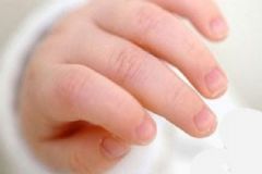 小孩手上長倒刺缺什么？小孩手上有倒刺怎么回事？[圖]