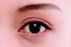 眼睛有紅血絲是什么原因？眼睛有紅血絲是什么導(dǎo)致的？[圖]