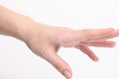 手背上骨頭突出是怎么回事？骨頭突出是得了什么??？[圖]