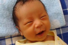 母乳性黃疸的危害有哪些？母乳性黃疸有危害嗎？[圖]