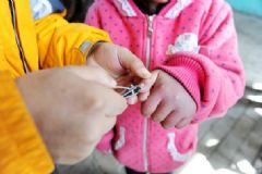 小孩指甲軟是怎么回事？小孩指甲軟是缺什么？[圖]