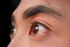 男士眼袋怎么消除？男士眼袋消除方法[圖]