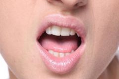 嘴唇上火起泡怎么辦？嘴唇上火起泡怎么快速消除？[圖]
