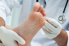 腳脫皮是怎么回事？腳脫皮是什么原因？[圖]