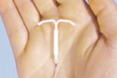 放節(jié)育環(huán)后應(yīng)注意什么？放節(jié)育環(huán)注意事項[圖]