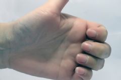 灰指甲的治療偏方有哪些？灰指甲偏方是什么？[圖]