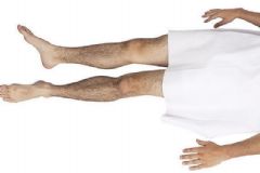 男性腿毛多說明了什么？男性腿毛多是什么原因？[圖]
