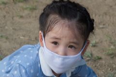 水痘如何預(yù)防？水痘的臨床癥狀[圖]