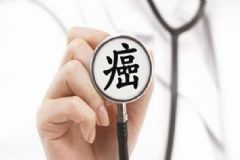 肝癌有什么預(yù)兆？肝癌的誤區(qū)謠傳[圖]