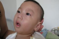 寶寶腦癱的早期癥狀有哪些？寶寶腦癱早期表現(xiàn)是什么？[圖]