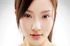 眼皮浮腫是什么原因？眼皮浮腫是怎么回事？[圖]