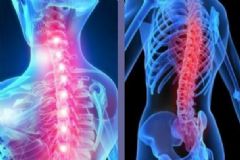 強直性脊柱炎吃什么食物？強直性脊柱炎吃什么好？[圖]