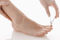 腳趾甲變厚是什么原因？腳趾甲為什么會(huì)變厚？[圖]